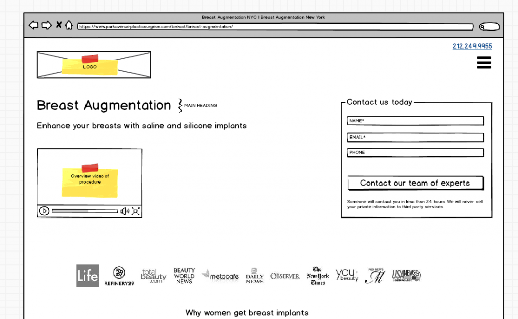 Breast augmentation page wireframe