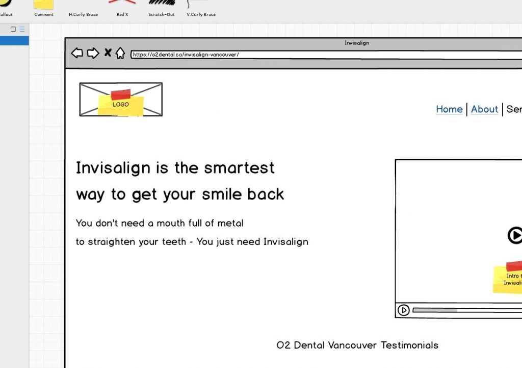 Invisalign page wireframe